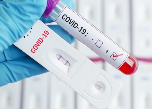 2181 нови случая на COVID-19 за последното денонощие